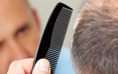 Ortica per capelli: tisane e trattamenti naturali per una chioma sana Ortica per capelli: tisane e trattamenti naturali per una chioma sana