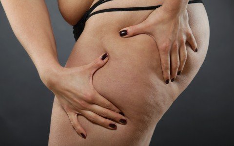 Come combattere la cellulite Come combattere la cellulite